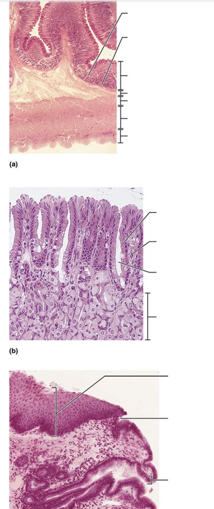 Histology Of Stomach And Esophagus Stomach Junction Diagram Quizlet