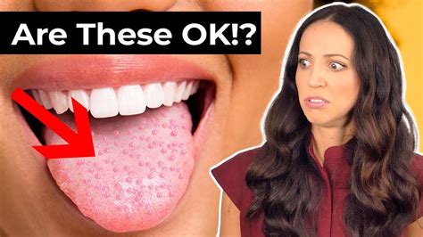Should I Be Worried About Bumps On Your Tongue Youtube Good Mental Health Oral Health