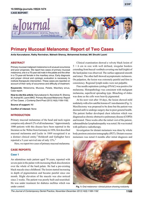 Pdf Primary Mucosal Melanoma Report Of Two Cases