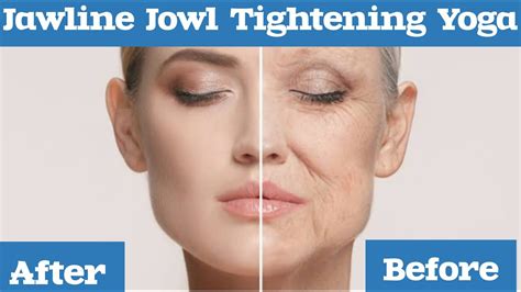 Get Rid Of Jowls Without Surgery Jowl Tightening Face Lifting Face