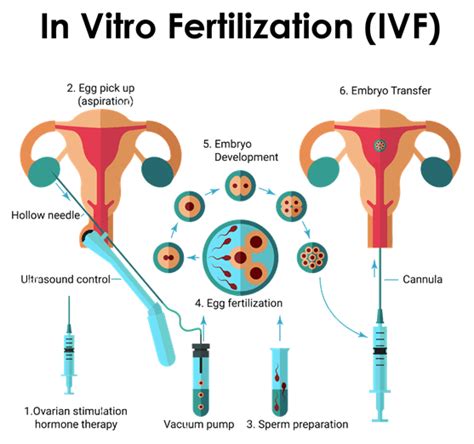 In Vitro Fertilization Ivf Treatment In India Top Highest Success Rate Ivf In Delhi Ncr