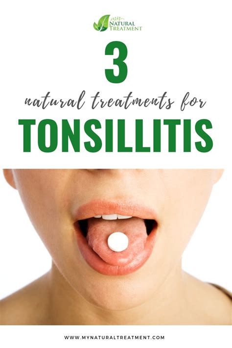 3 Best Natural Treatments For Tonsillitistonsillitis Remedy