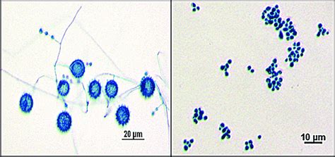Representative Micromorphology Of H Capsulatum Mycelium And Yeast