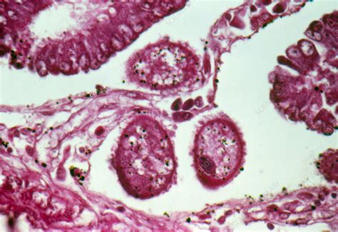 Lm Of Balantidium Coli Parasitic In The Intestine Stock Image Z105