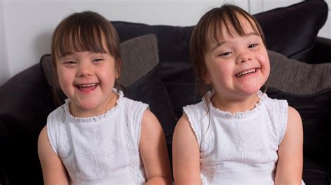 Downs Syndrome Twins Are One In A Million Youtube