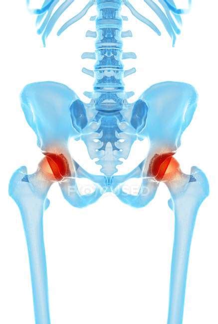 Human Hip Pain — Artwork Muscles Stock Photo 160558686