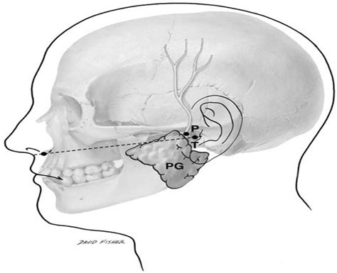 Parotid Branches Of The Auriculotemporal Nerve An Anatomica