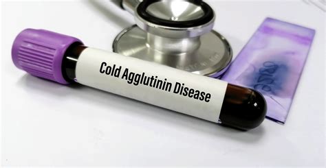 Sutimlimab Receives Eu Approval For Cold Agglutinin Haemolytic Anaemia