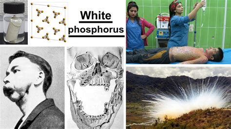 White Phosphorus Youtube