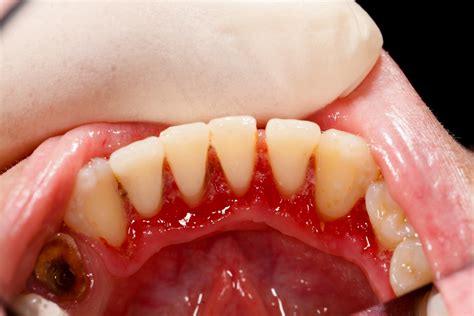 Dental Diagnostics Your Dentist Could Save Your Life