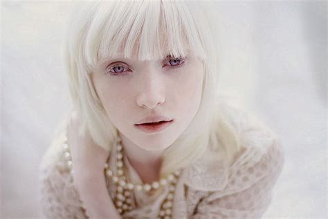 Nastya Zhidkova Albino Model Purple Eyes Albino