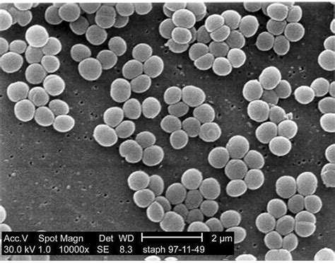 What Is Staphylococcus Aureus The Baceria That Causes Staph