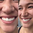 55 Impressive Smiley Piercing Ideas - Trendy in (2019)