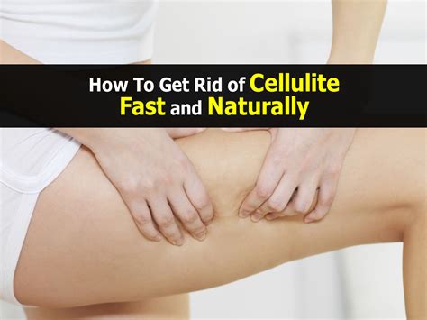 How To Get Rid Of Cellulite Fast And Naturally