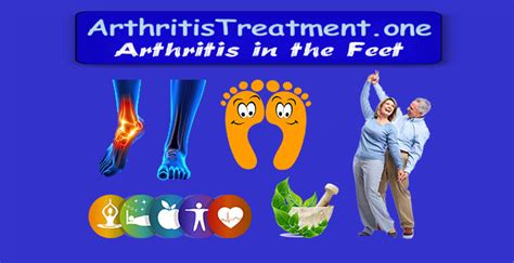 Arthritis In The Feet Arthritis Treatment