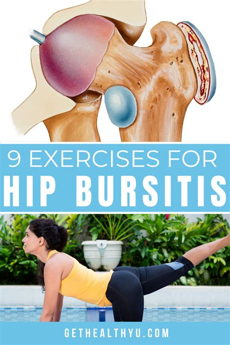 Exercises To Treat Hip Bursitis Bursitis Hip Bursitis Hip The Best
