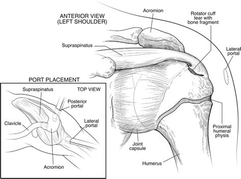 Anterior View Of The Left Shoulder Joint In A Pediatric Patient Shows