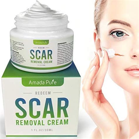Best Scar Removal Creams Of Reviews Buying Guide Scar Removal Cream Acne Scar