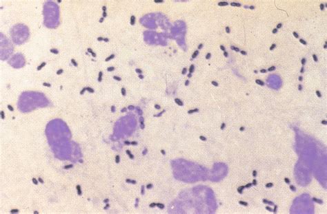 Gram Positive Cocci Examples Hybridization Examples Of Gram Positive