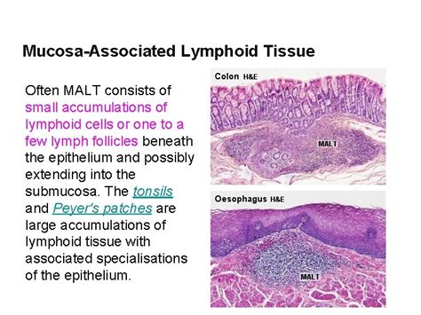 Lymphoid Or Lymphatic Tissues Which Mainly Consist Of