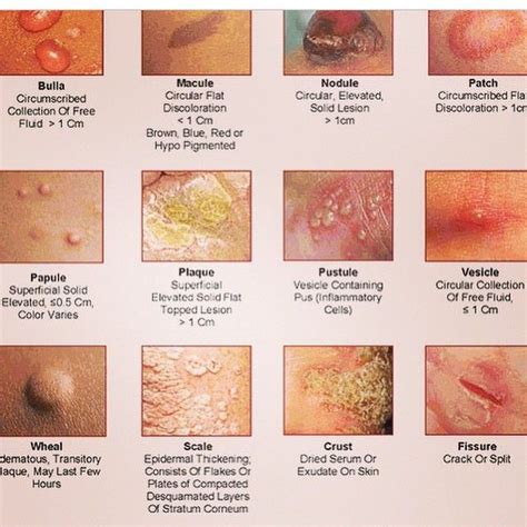 Medical Doctor On Instagram “different Skin Rashes Rash Skin Scale