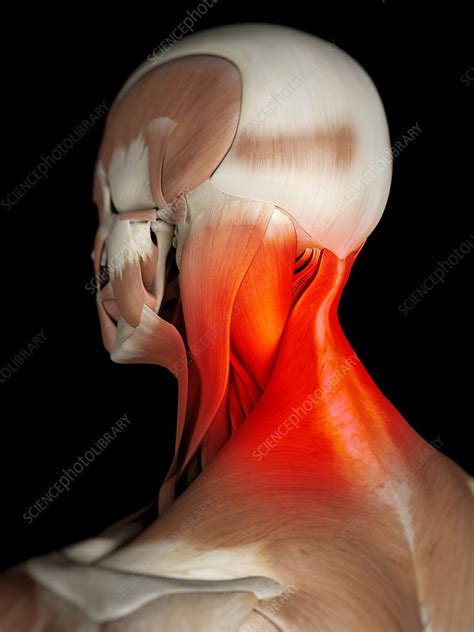 Human Neck Muscles Artwork Stock Image F009 4102 Science Photo