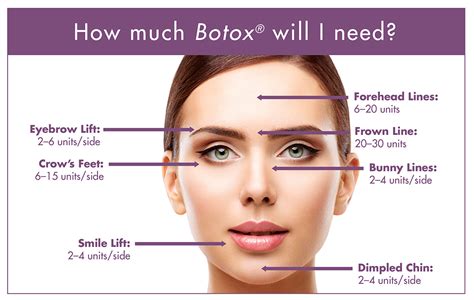 Allergan Botox Face Map