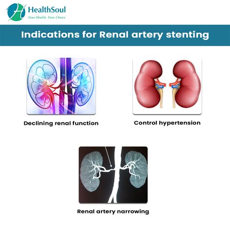 Renal Artery Stenting Indications And Complications Healthsoul