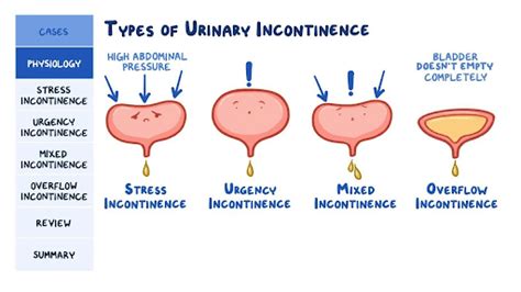 Best Urinary Incontinence Treatment In Dubai Home