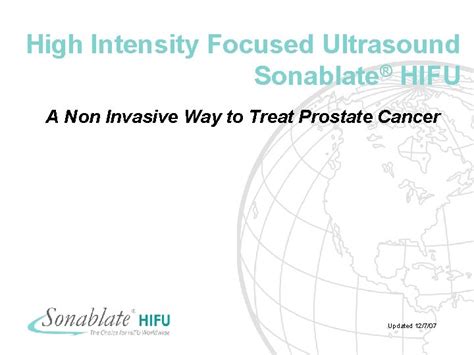 High Intensity Focused Ultrasound Sonablate HIFU A Non