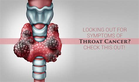 Common Symptoms Of Throat Cancer