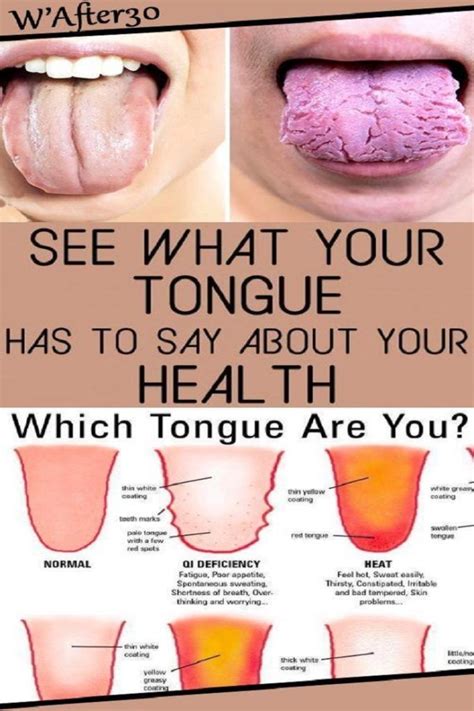 3 Things Your Tongue Is Trying To Reveal About Your Health Health