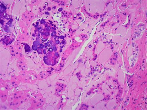 A Collection Of Surgical Pathology Images