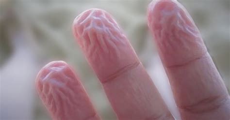 Why Do Wrinkles Develop In Our Fingers When They Are Immersed In Water For A Long Time My Qa