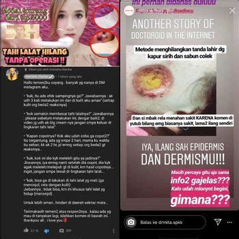 Kalau tak, rugilah kalau terpaksa dibuang. Bukan Pakai Sabun Colek, Ini Cara Hilangkan Tahi Lalat ...