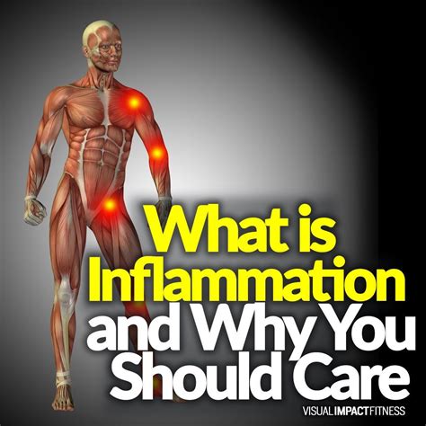 What Is Inflammation And Why You Should Care With Images Muscle