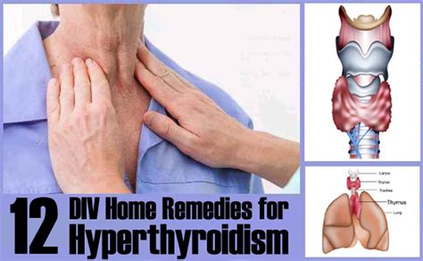 12 Diy Home Remedies For Hyperthyroidism