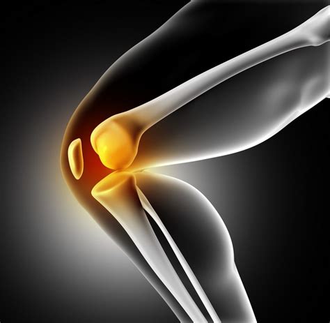 Know Your Pain 4 Common Causes Of Knee Pain Part 2 Orlando Walters DPT