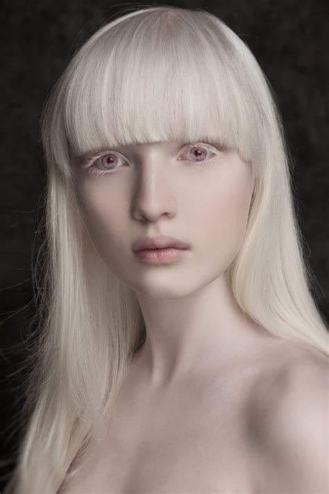 Meet Nastya Zhidkova The Most Beautiful Albino Girl In The World Celebrities Nigeria