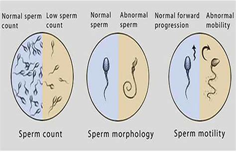 Falling Sperm Counts Could Lead To End Of Human Race Study Punch