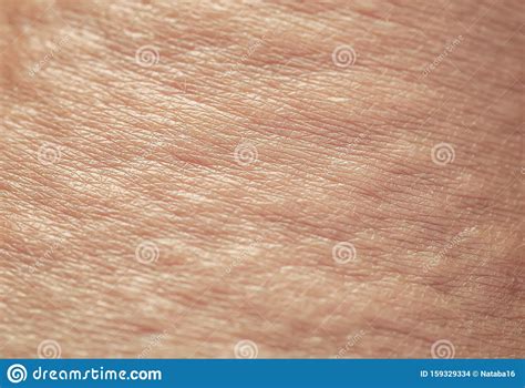 Background Of The Texture Unhealthy Irritated Human Skin Is Covered