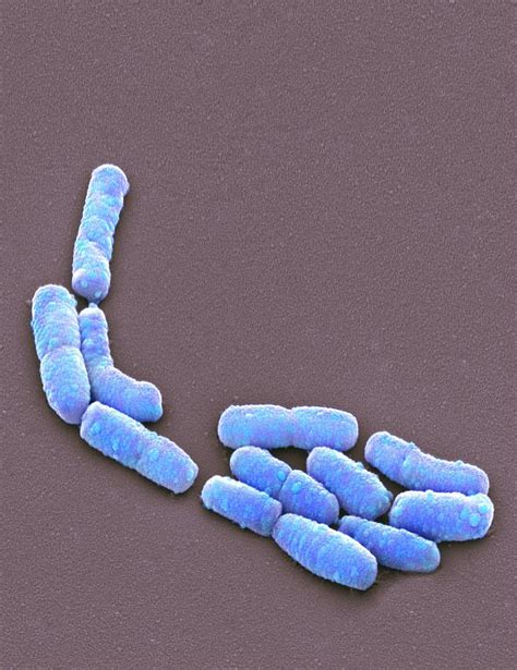 E Coli Bacteria Sem Photograph By Steve Gschmeissner Pixels