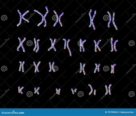 Philadelphia Chromosome Karyotype Stock Illustration Illustration Of