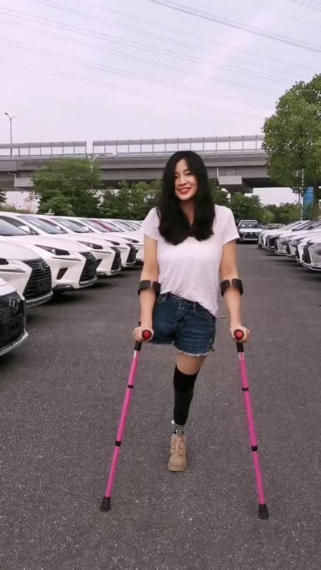 Amputee Lover — Legless Girl Walks On The Only Artificial Leg With