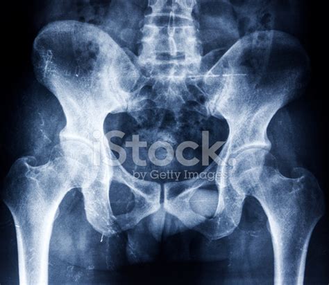 Male Pelvis X Ray Anatomy