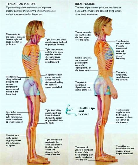 Typical Bad Posture Tight Muscles Pull The Skeleton Out Of Alignment Creating Awkward And