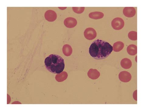 The Characterization Of Basophils In Peripheral Blood A Peripheral