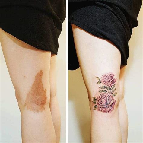🖤 ¿se Puede Tatuar En Piel Con Manchas 🖤 Love Tattoos Amino