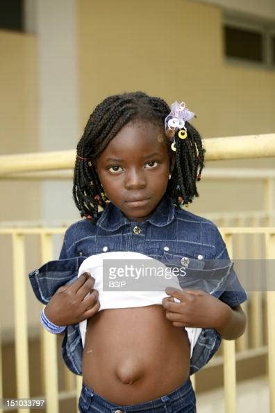 Photo Essay In A Hospital In Congo Chain Of Hope Girl With A Photo