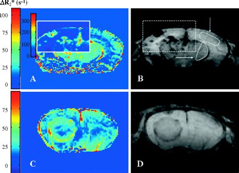 Characterization Of Tumor Vasculature In Mouse Brain By Uspio Contrast